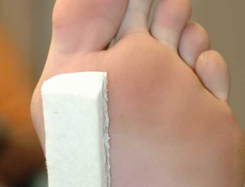 What Is Morton’s Toe Syndrome? Causes & Treatment
