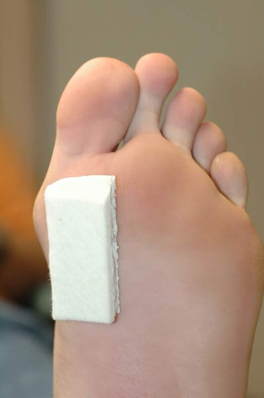 small big toe, pain in knee, calloused feet