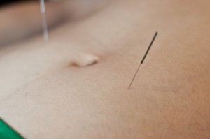 boost fertility with acupuncture