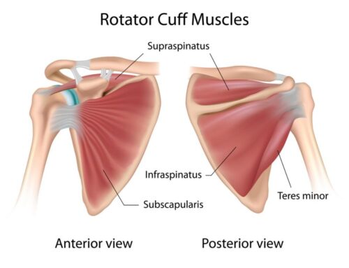 Frozen Shoulder – The Subscapularis Muscle