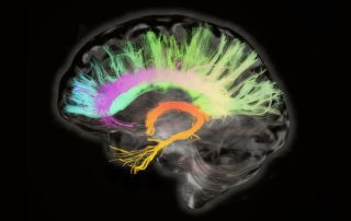 These 9 Techniques Will Help You Stop Forgetting Things All The Time