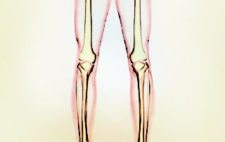 Is It Time For Joint Surgery? Here's How To Know