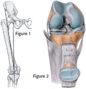 The Role of the Q Angle in Anterior Knee Pain