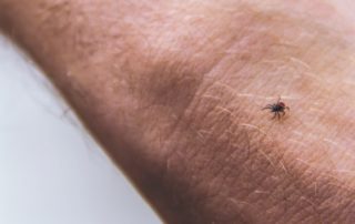 Chigger Bites (+ 5 Natural Home Remedies for Chigger Bite Symptoms)