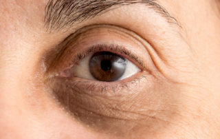 What Happens to Your Body When You Stop Drinking Water