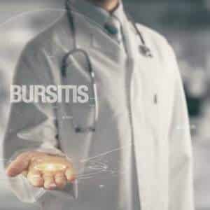 bursitis can result in upper arm pain in the bicep