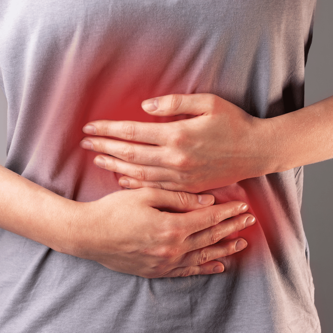 Managing Crohn’s Disease flare-ups