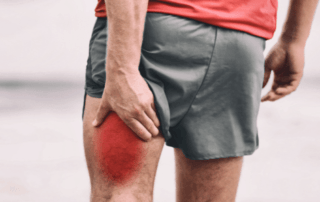 pulled muscle bruise