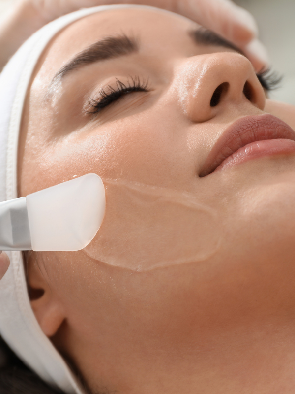 chemical peel ad chemical peel
