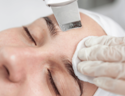 Reveal Your Best Skin: Discover the Best Facial Extractions Near You