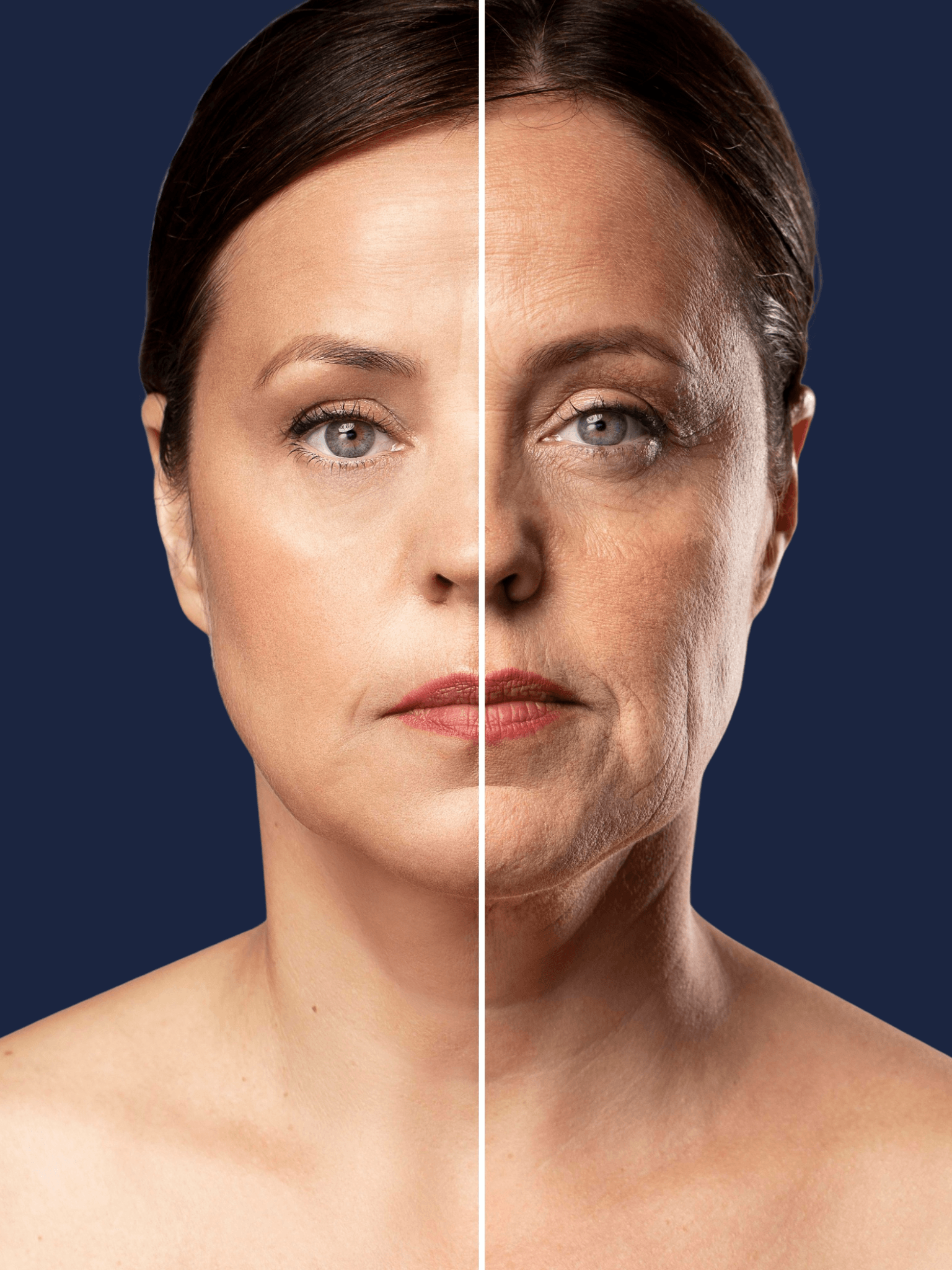 microneedling before and after microneedling