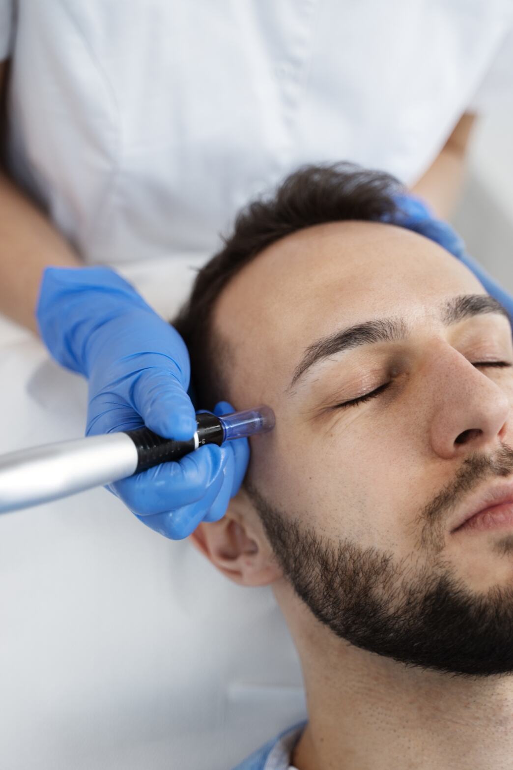 microneedling for men microneedling in canal winchester
