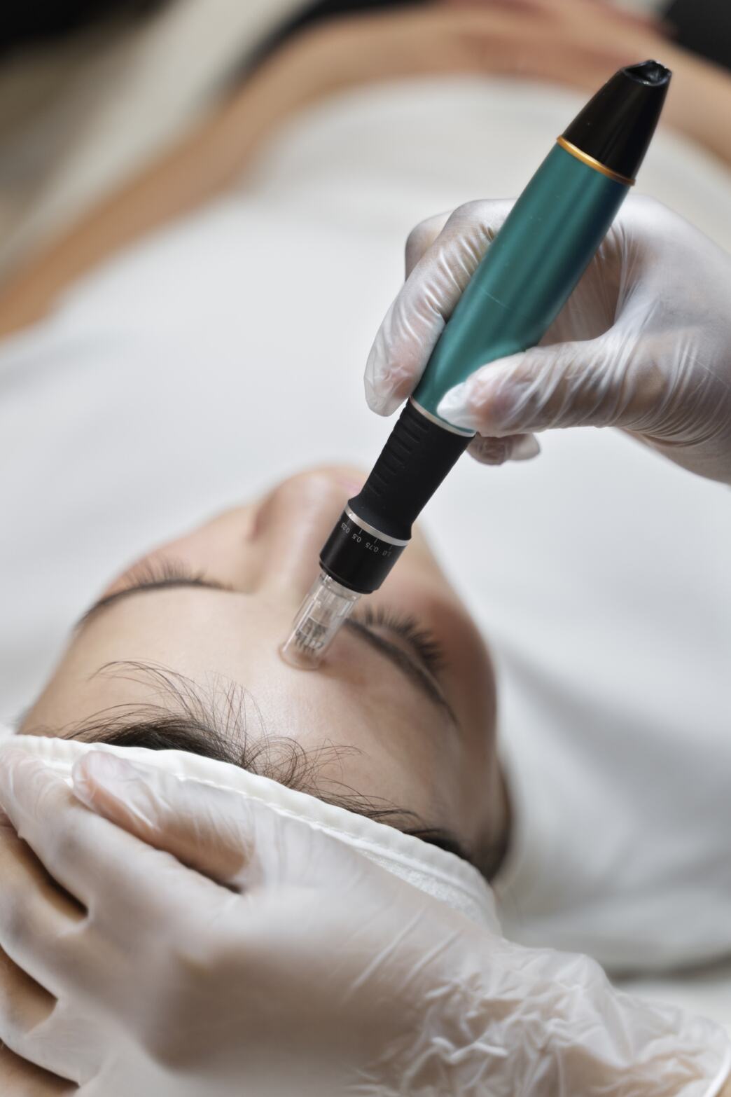 collagen induction pickerington microneedling reynoldsburg