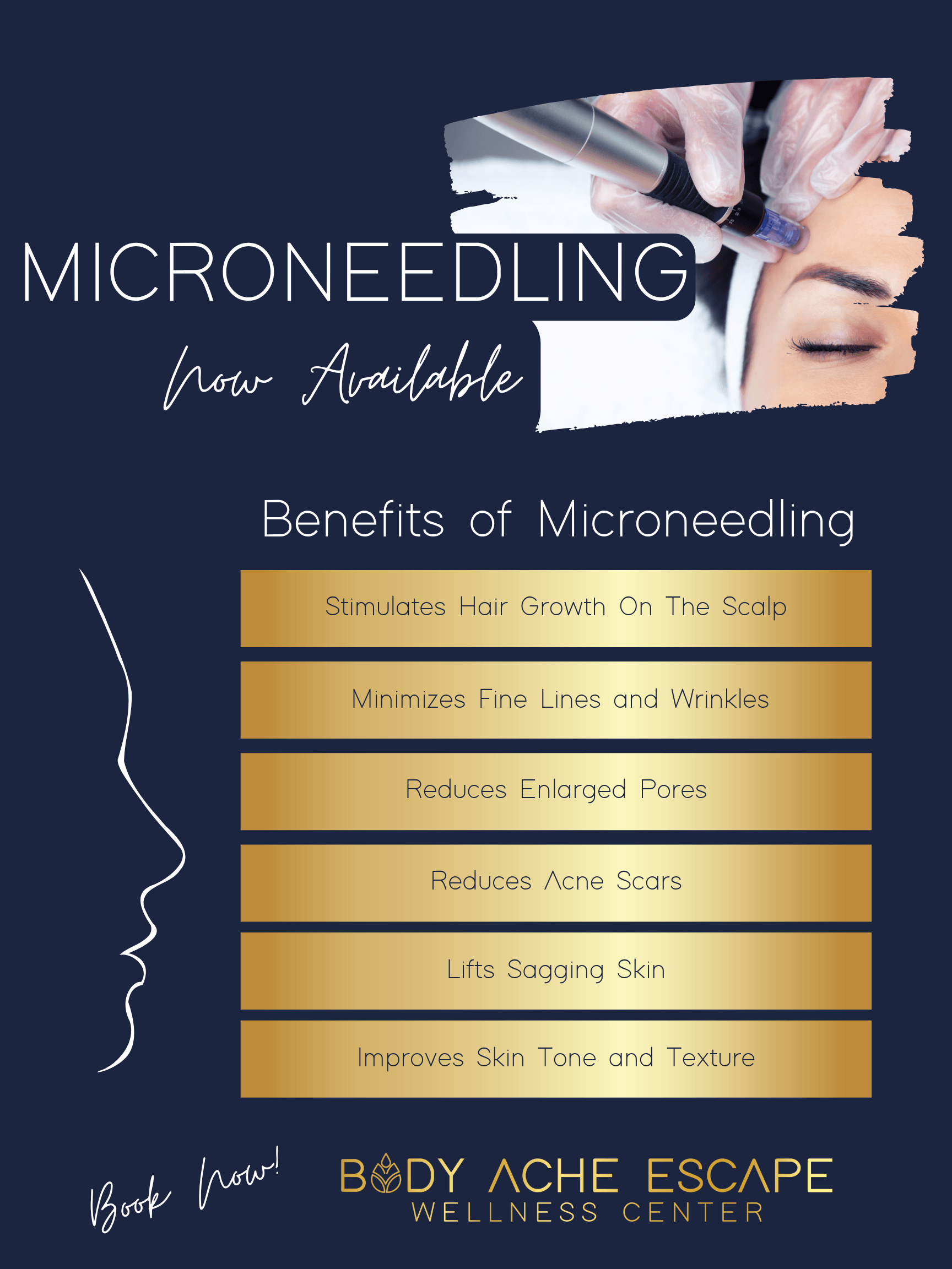 Microneedling in Pickerington microneedling in Pickerington