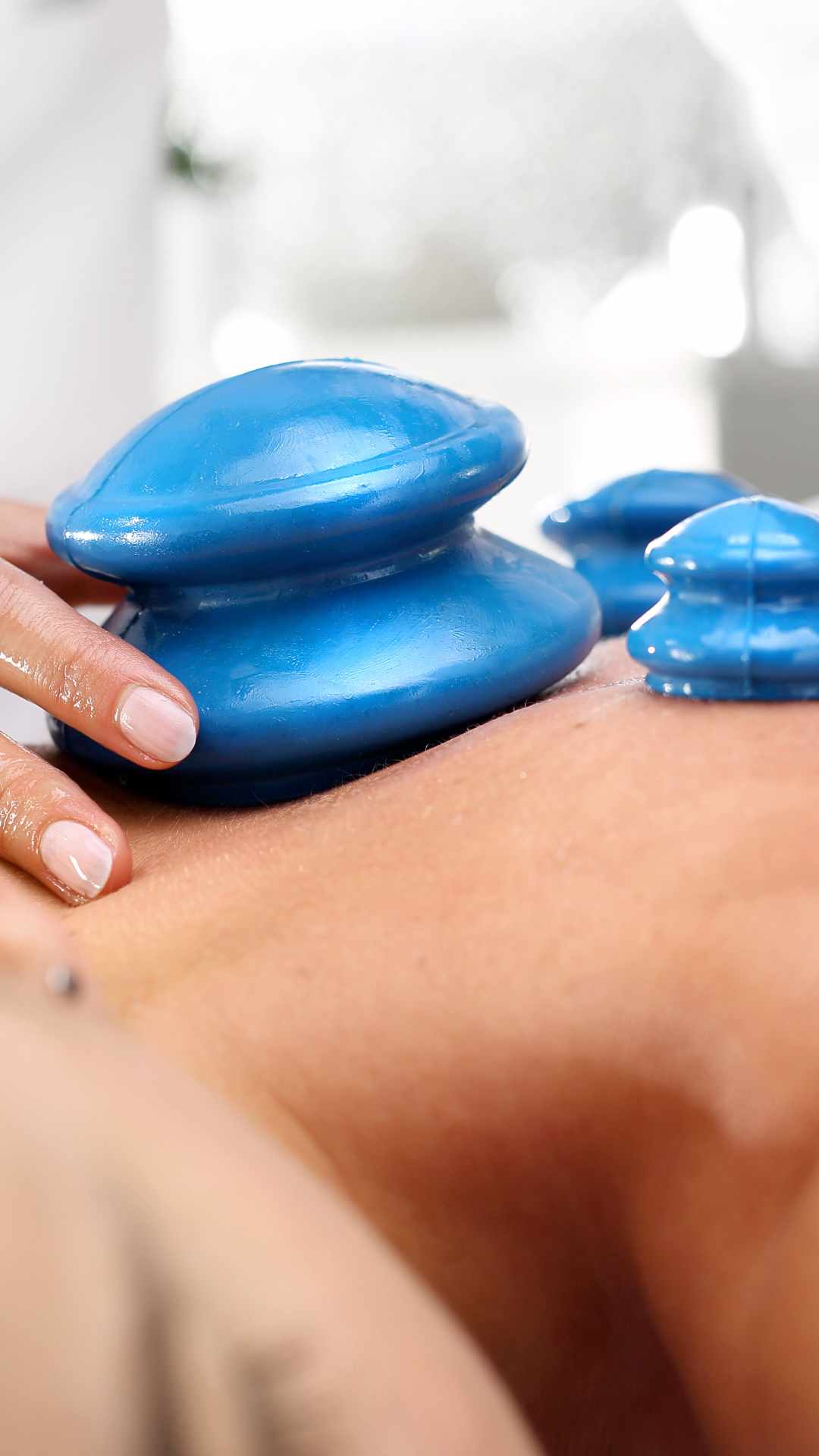 cupping massage for lower back pain